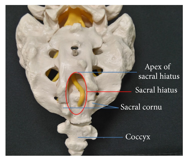 Caudal approach — posterior sacral anatomy